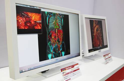 三大系列十款产品 美国优派亮相医疗展 
